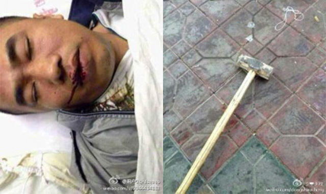 Nhân chứng bị công an đánh bằng búa tạ đến ói máu và đã chết trên đường đến bệnh viện. Nguồn Weibo